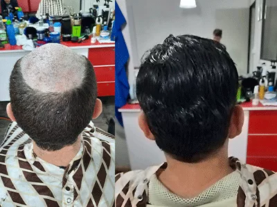 Qualidade de vida